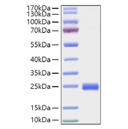 SDS-PAGE - Recombinant Mouse IL-2 Protein (C-terminal His Tag) (A330855) - Antibodies.com