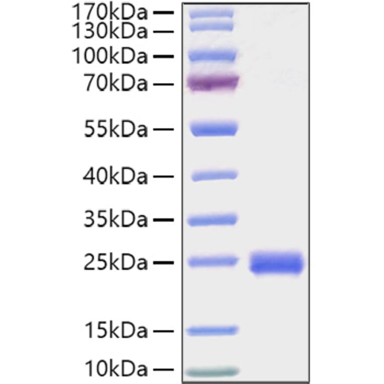 SDS-PAGE - Recombinant Mouse IL-2 Protein (C-terminal His Tag) (A330855) - Antibodies.com