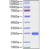 SDS-PAGE - Recombinant Mouse IL-2 Protein (C-terminal His Tag) (A330855) - Antibodies.com