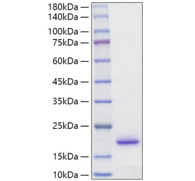 SDS-PAGE - Recombinant Rat IL-2 Protein (C-terminal His Tag) (A330856) - Antibodies.com