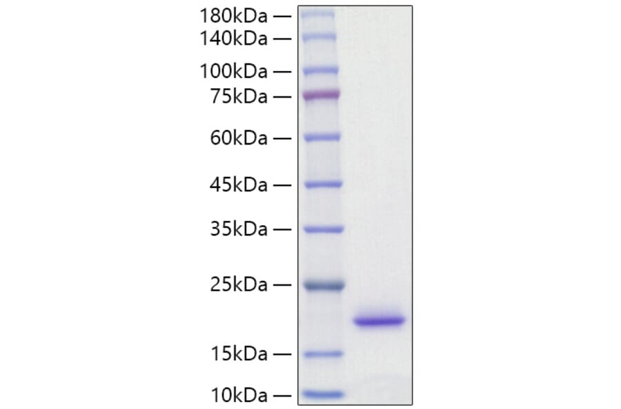SDS-PAGE - Recombinant Rat IL-2 Protein (C-terminal His Tag) (A330856) - Antibodies.com