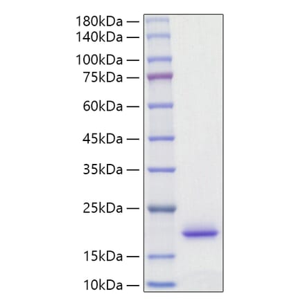 SDS-PAGE - Recombinant Rat IL-2 Protein (C-terminal His Tag) (A330856) - Antibodies.com
