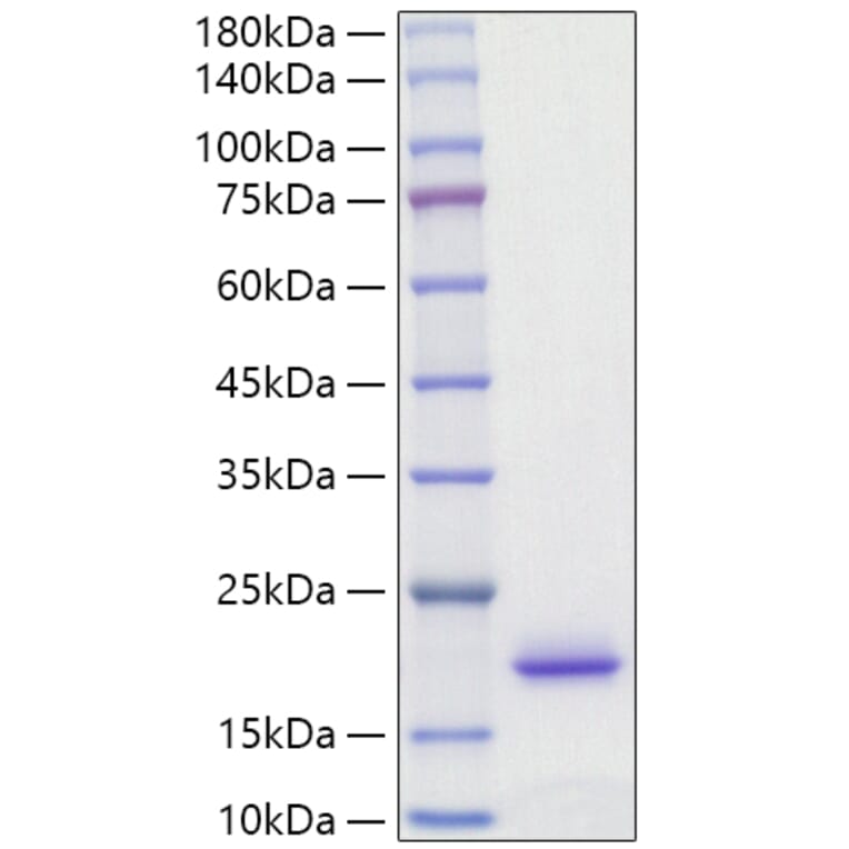 SDS-PAGE - Recombinant Rat IL-2 Protein (C-terminal His Tag) (A330856) - Antibodies.com