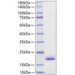 SDS-PAGE - Recombinant Rat IL-2 Protein (C-terminal His Tag) (A330856) - Antibodies.com
