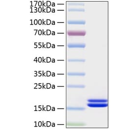 SDS-PAGE - Recombinant Human IL-2 Protein (C-terminal His Tag) (A330857) - Antibodies.com