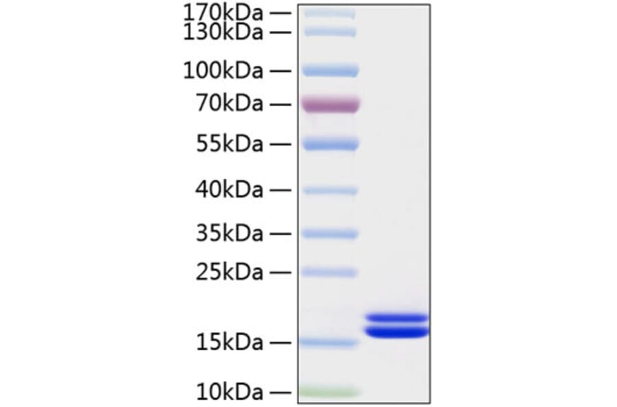 SDS-PAGE - Recombinant Human IL-2 Protein (C-terminal His Tag) (A330857) - Antibodies.com