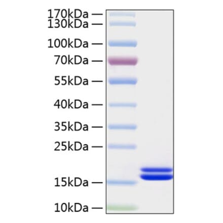 SDS-PAGE - Recombinant Human IL-2 Protein (C-terminal His Tag) (A330857) - Antibodies.com