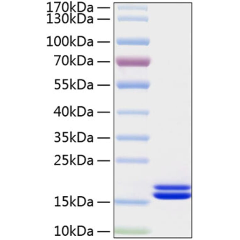 SDS-PAGE - Recombinant Human IL-2 Protein (C-terminal His Tag) (A330857) - Antibodies.com