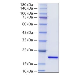 SDS-PAGE - Recombinant Mouse IL-20 Protein (N-terminal His Tag) (A330858) - Antibodies.com
