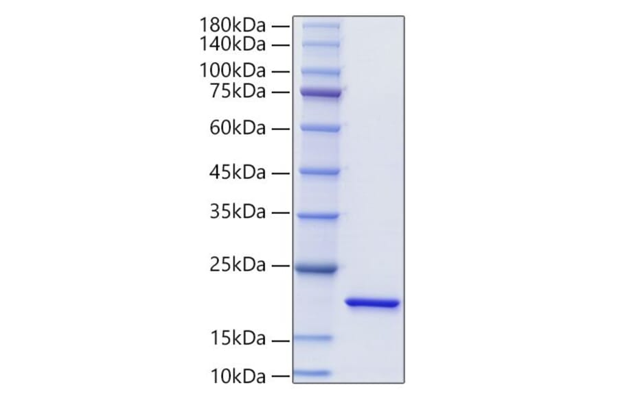 SDS-PAGE - Recombinant Mouse IL-20 Protein (N-terminal His Tag) (A330858) - Antibodies.com