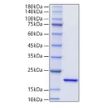 SDS-PAGE - Recombinant Mouse IL-20 Protein (N-terminal His Tag) (A330858) - Antibodies.com