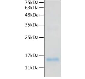 SDS-PAGE - Recombinant Human IL-20 Protein (C-terminal His Tag) (A330859) - Antibodies.com