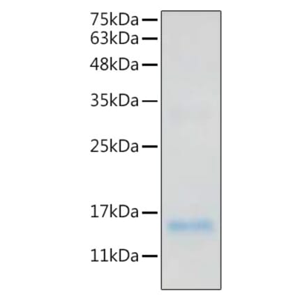 SDS-PAGE - Recombinant Human IL-20 Protein (C-terminal His Tag) (A330859) - Antibodies.com