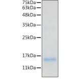 SDS-PAGE - Recombinant Human IL-20 Protein (C-terminal His Tag) (A330859) - Antibodies.com