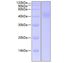 SDS-PAGE - Recombinant Human IL-20R1 Protein (C-terminal His Tag) (A330860) - Antibodies.com