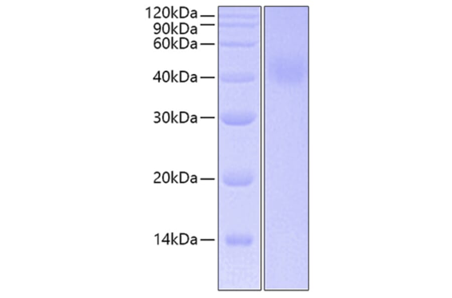 SDS-PAGE - Recombinant Human IL-20R1 Protein (C-terminal His Tag) (A330860) - Antibodies.com