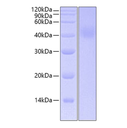 SDS-PAGE - Recombinant Human IL-20R1 Protein (C-terminal His Tag) (A330860) - Antibodies.com