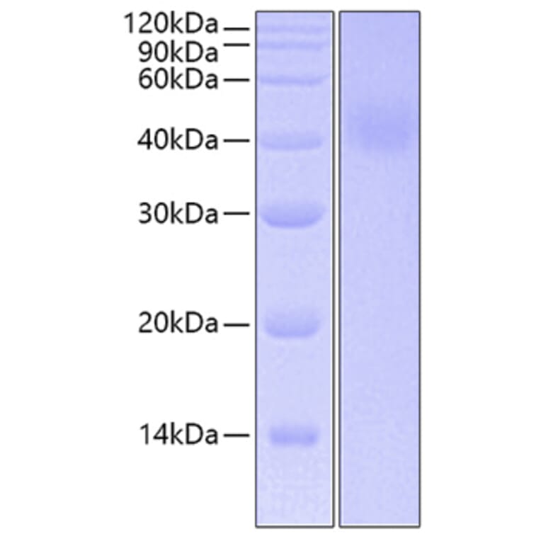 SDS-PAGE - Recombinant Human IL-20R1 Protein (C-terminal His Tag) (A330860) - Antibodies.com