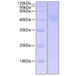SDS-PAGE - Recombinant Human IL-20R1 Protein (C-terminal His Tag) (A330860) - Antibodies.com