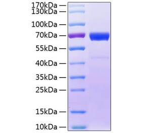 SDS-PAGE - Recombinant Human IL20RB Protein (C-terminal Fc Tag) (A330861) - Antibodies.com