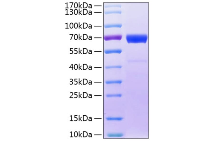 SDS-PAGE - Recombinant Human IL20RB Protein (C-terminal Fc Tag) (A330861) - Antibodies.com