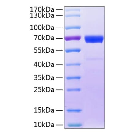 SDS-PAGE - Recombinant Human IL20RB Protein (C-terminal Fc Tag) (A330861) - Antibodies.com