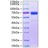 SDS-PAGE - Recombinant Human IL20RB Protein (C-terminal Fc Tag) (A330861) - Antibodies.com