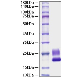 SDS-PAGE - Recombinant Rat IL-21 Protein (C-terminal His Tag) (A330862) - Antibodies.com