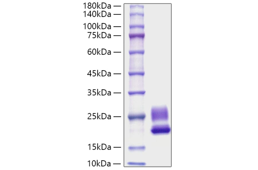 SDS-PAGE - Recombinant Rat IL-21 Protein (C-terminal His Tag) (A330862) - Antibodies.com