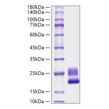 SDS-PAGE - Recombinant Rat IL-21 Protein (C-terminal His Tag) (A330862) - Antibodies.com