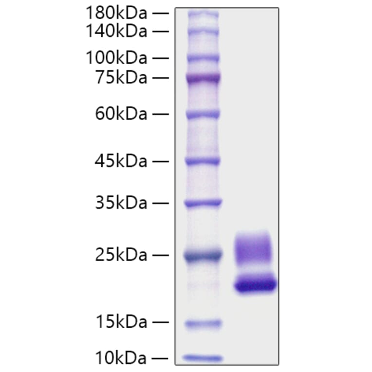 SDS-PAGE - Recombinant Rat IL-21 Protein (C-terminal His Tag) (A330862) - Antibodies.com