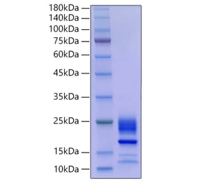 SDS-PAGE - Recombinant Mouse IL-21 Protein (C-terminal His Tag) (A330863) - Antibodies.com