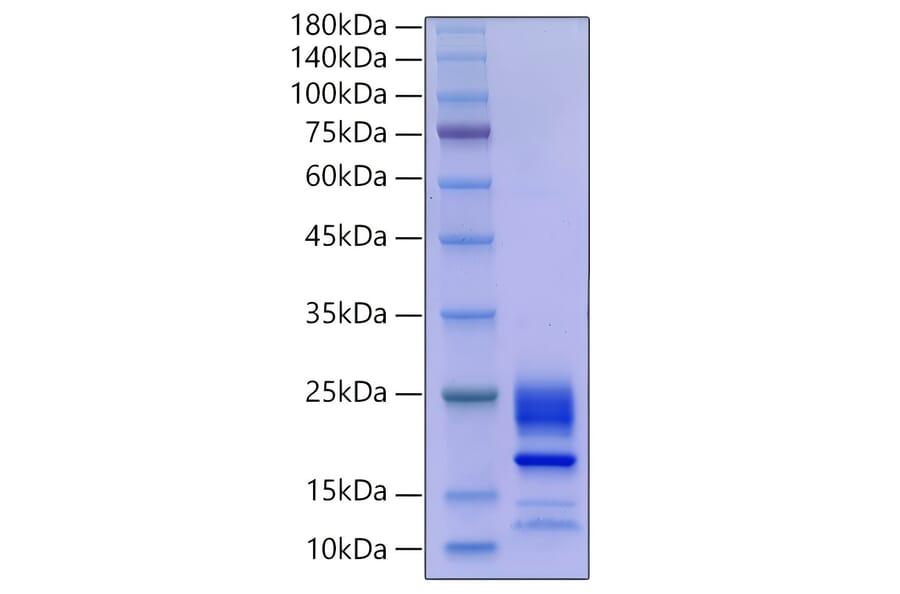 SDS-PAGE - Recombinant Mouse IL-21 Protein (C-terminal His Tag) (A330863) - Antibodies.com