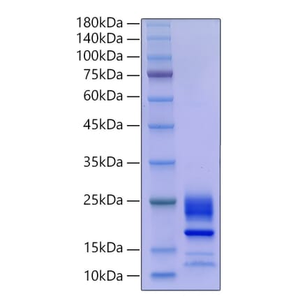SDS-PAGE - Recombinant Mouse IL-21 Protein (C-terminal His Tag) (A330863) - Antibodies.com