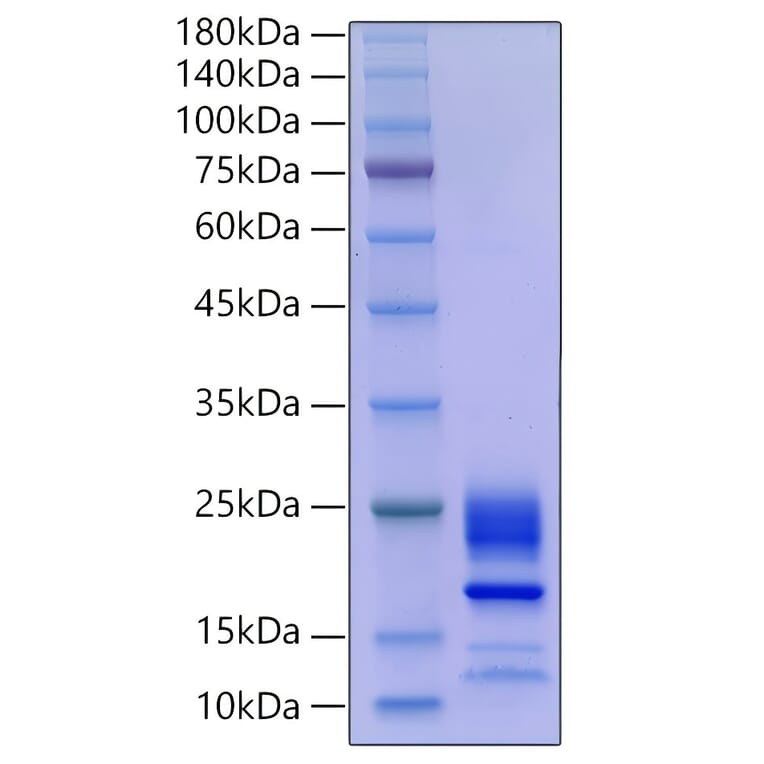 SDS-PAGE - Recombinant Mouse IL-21 Protein (C-terminal His Tag) (A330863) - Antibodies.com