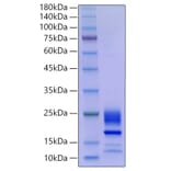 SDS-PAGE - Recombinant Mouse IL-21 Protein (C-terminal His Tag) (A330863) - Antibodies.com