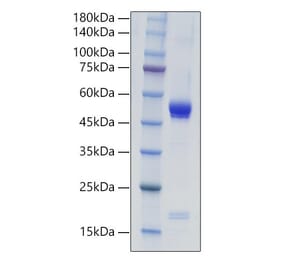 SDS-PAGE - Recombinant Mouse IL-21 Protein (C-terminal Human Fc Tag) (A330864) - Antibodies.com