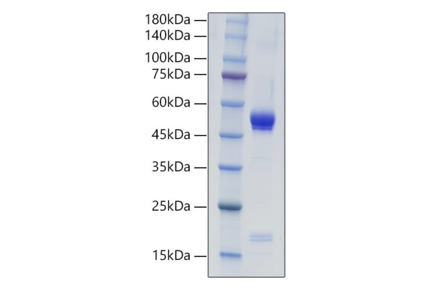 SDS-PAGE - Recombinant Mouse IL-21 Protein (C-terminal Human Fc Tag) (A330864) - Antibodies.com