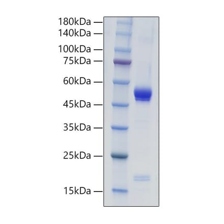 SDS-PAGE - Recombinant Mouse IL-21 Protein (C-terminal Human Fc Tag) (A330864) - Antibodies.com