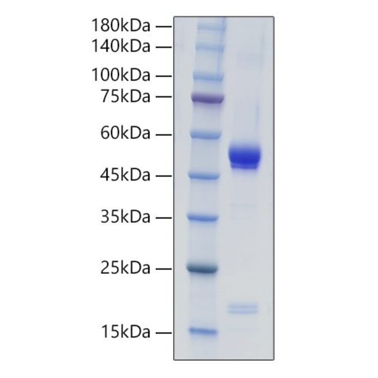 SDS-PAGE - Recombinant Mouse IL-21 Protein (C-terminal Human Fc Tag) (A330864) - Antibodies.com
