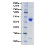 SDS-PAGE - Recombinant Mouse IL-21 Protein (C-terminal Human Fc Tag) (A330864) - Antibodies.com