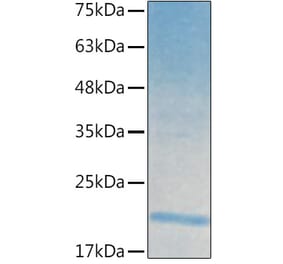 SDS-PAGE - Recombinant Human IL-21 Protein (C-terminal His Tag) (A330865) - Antibodies.com