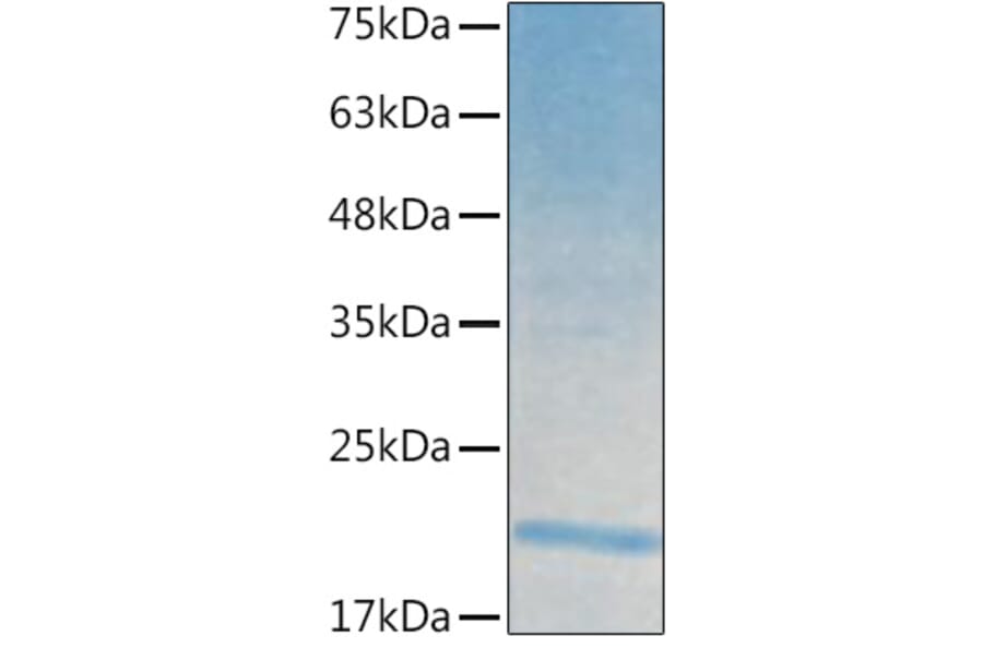SDS-PAGE - Recombinant Human IL-21 Protein (C-terminal His Tag) (A330865) - Antibodies.com