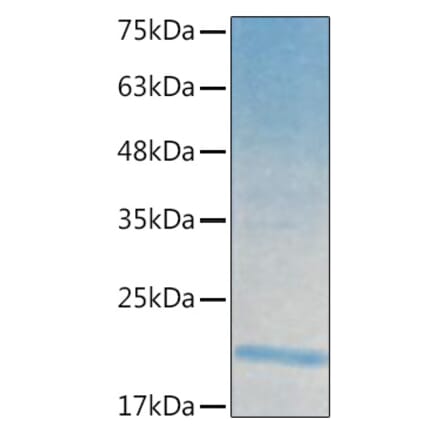SDS-PAGE - Recombinant Human IL-21 Protein (C-terminal His Tag) (A330865) - Antibodies.com