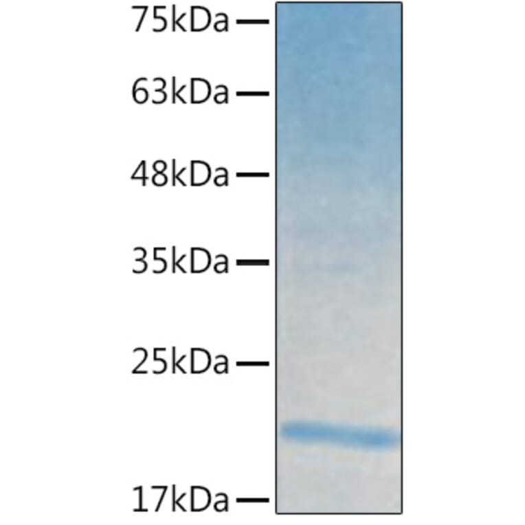 SDS-PAGE - Recombinant Human IL-21 Protein (C-terminal His Tag) (A330865) - Antibodies.com