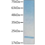 SDS-PAGE - Recombinant Human IL-21 Protein (C-terminal His Tag) (A330865) - Antibodies.com