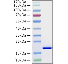 SDS-PAGE - Recombinant Human IL-21 Protein (C-terminal His Tag) (A330866) - Antibodies.com