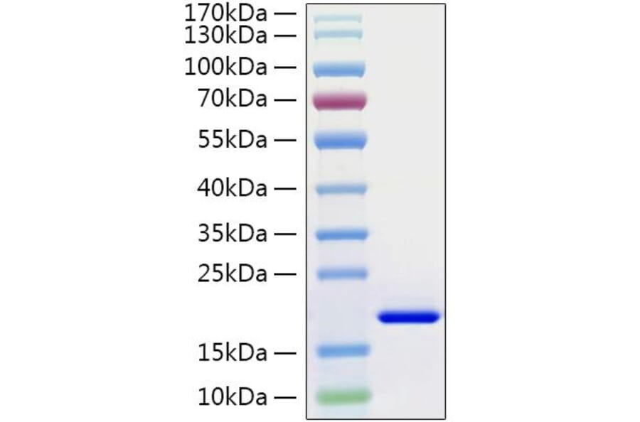 SDS-PAGE - Recombinant Human IL-21 Protein (C-terminal His Tag) (A330866) - Antibodies.com