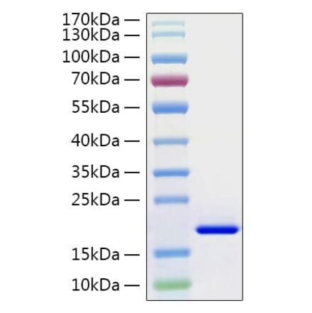 SDS-PAGE - Recombinant Human IL-21 Protein (C-terminal His Tag) (A330866) - Antibodies.com