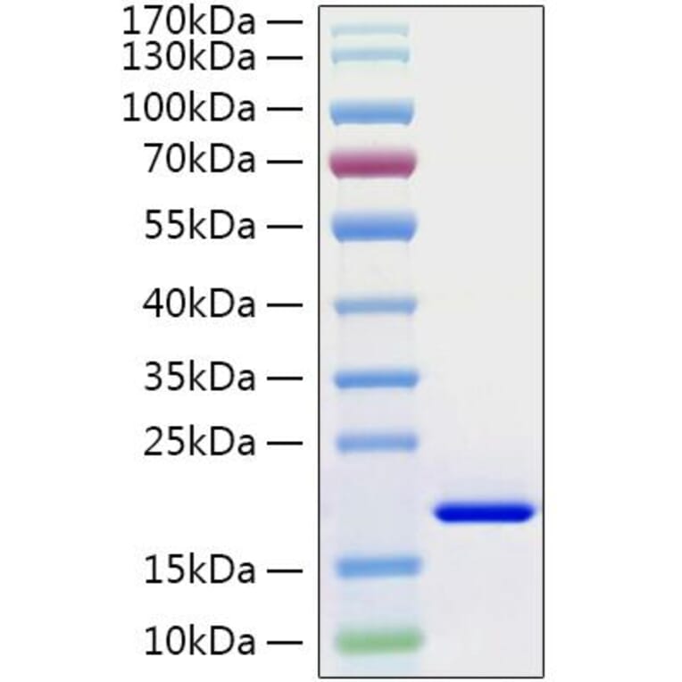 SDS-PAGE - Recombinant Human IL-21 Protein (C-terminal His Tag) (A330866) - Antibodies.com